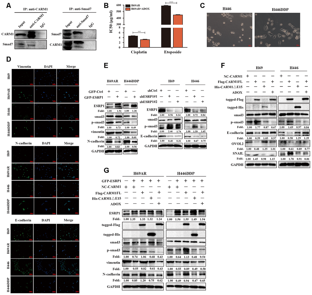 CARM1 activates TGF-β/Smad signaling pathway by regulating arginine methylation of Smad7. (A) Co-IP assays were conducted with specific CARM1 antibody and Smad7 antibody in H69AR cells. (B) H69AR cells were treated with 5 μM ADOX for 48 hours, then cells were exposed to cisplatin or etoposide for 24 hours, and IC50 values were measured by CCK8 assays. (C) Comparison of the basic morphology of chemosensitive cells and chemoresistant cells by optical microscope. (D) Immunofluorescence staining shows the expression of EMT marker protein. (E) The expression of ESRP1, Smad3, p-Smad3 and EMT-related proteins in stably upregulated or downregulated SCLC cells was detected by western blot assay. (F) Overexpressed CARM1FL or CARM1ΔE15 in H69 and H446 cells or treated cells with ADOX for 48 hours, western blot assay was performed to detect the expression of tag antibodies, Smad3, p-Smad3 and EMT-related proteins. (G) Overexpressed CARM1FL or CARM1ΔE15 in ESRP1-upregulated H69AR and H446DDP cells or treated cells with ADOX for 48 hours, western blot assay was performed to detect the expression of tag antibodies, Smad3, p-Smad3 and EMT-related proteins. *, pp p p 