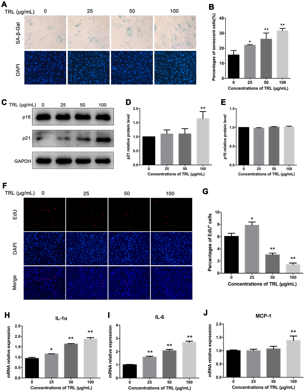 Postprandial TRL induced premature senescence and SASP in AMSCs. (A, B) AMSCs reached approximately 30%-40% culture-confluence were incubated with 0, 25, 50, or 100 μg/mL postprandial TRL for 8 d, and then SA-β-Gal (upper row) and DAPI (lower row) double staining was performed to detect the senescent cells and nuclei, respectively (A). Images were obtained under a microscope (×200 magnification). SA-β-Gal positive cells were counted manually by scanning a total of 200 cells in each sample (B). (C–E) Protein levels of senescent markers, p21 and p16, were detected using western blotting (C), and then the relative protein levels of p21 (D) and p16 (E) were analyzed using ImageJ. (F, G) The proliferation capacity of AMSCs incubated with different concentrations of postprandial TRL was measured using an EdU incorporation assay (F) and the EdU positive cells were counted using ImageJ (G). Images were obtained under a microscope (×100 magnification). (H–J) Expression levels of genes encoding senescence-related inflammatory cytokines, including IL-1α (H), IL-6 (I), and MCP-1 (J), were detected using qRT-PCR in AMSCs incubated with postprandial TRL at 0, 25, 50, or 100 μg/mL for 8 d. Data are expressed as mean ± SD (n ≥ 3). *P **P 
