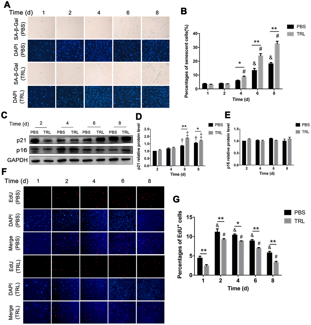 Postprandial TRL induced premature senescence of AMSCs in a time-dependent manner. (A, B) AMSCs reached approximately 30%-40% culture-confluence were incubated with PBS (two upper rows) or 100 μg/mL postprandial TRL (two lower rows) for 8 d, and then SA-β-Gal and DAPI staining was performed to detect the senescent cells and nuclei at day 1, 2, 4, 6, and 8 (A). Images were obtained under a microscope (×200 magnification). SA-β-Gal positive cells were counted manually by scanning a total of 200 cells in each sample (B). (C–E) Protein levels of p21 and p16 were detected using western blotting (C), and then the relative protein levels of p21 (D) and p16 (E) were analyzed using ImageJ. (F, G) The proliferation capacity of AMSCs incubated with PBS or 100 μg/mL postprandial TRL was measured using an EdU incorporation assay at day 1, 2, 4, 6, and 8, respectively (F) and EdU positive cells were counted using ImageJ (G). Images were obtained under a microscope (×100 magnification). Data are expressed as the mean ± SD (n ≥ 3). *P **P &P #P †P ‡P 