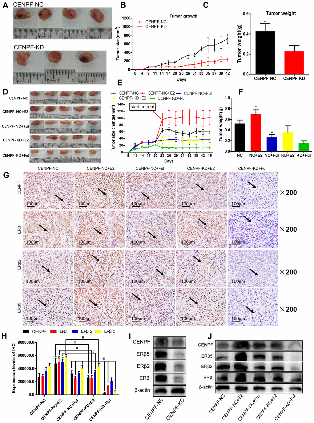 Knockdown of CENPF can inhibit ERβ2/5 pathway-mediated tumor tissue growth in vivo. (A) Pictures of mice tumor tissues after resection. (B, C) Analysis of tumor size and tumor weight. *P D) Tumor images of nude mice. (E, F) Statistical analysis of tumor size and tumor weight. (G, H) Immunohistochemical analysis of the expression of CENPF, ERβ, ERβ2 and ERβ5 in nude mice tumor tissues and corresponding quantified histograms. (I) Knockdown of CENPF inhibited the expression of ERβ2/5. (The corresponding gray value are shown in Supplementary Figure 5B). (J) Protein expression of CENPF, ERβ, ERβ1, ERβ2 and ERβ5 in vivo experiment after treated with E2 and Ful treatment (The corresponding gray value are shown in Supplementary Figure 5F). *P 