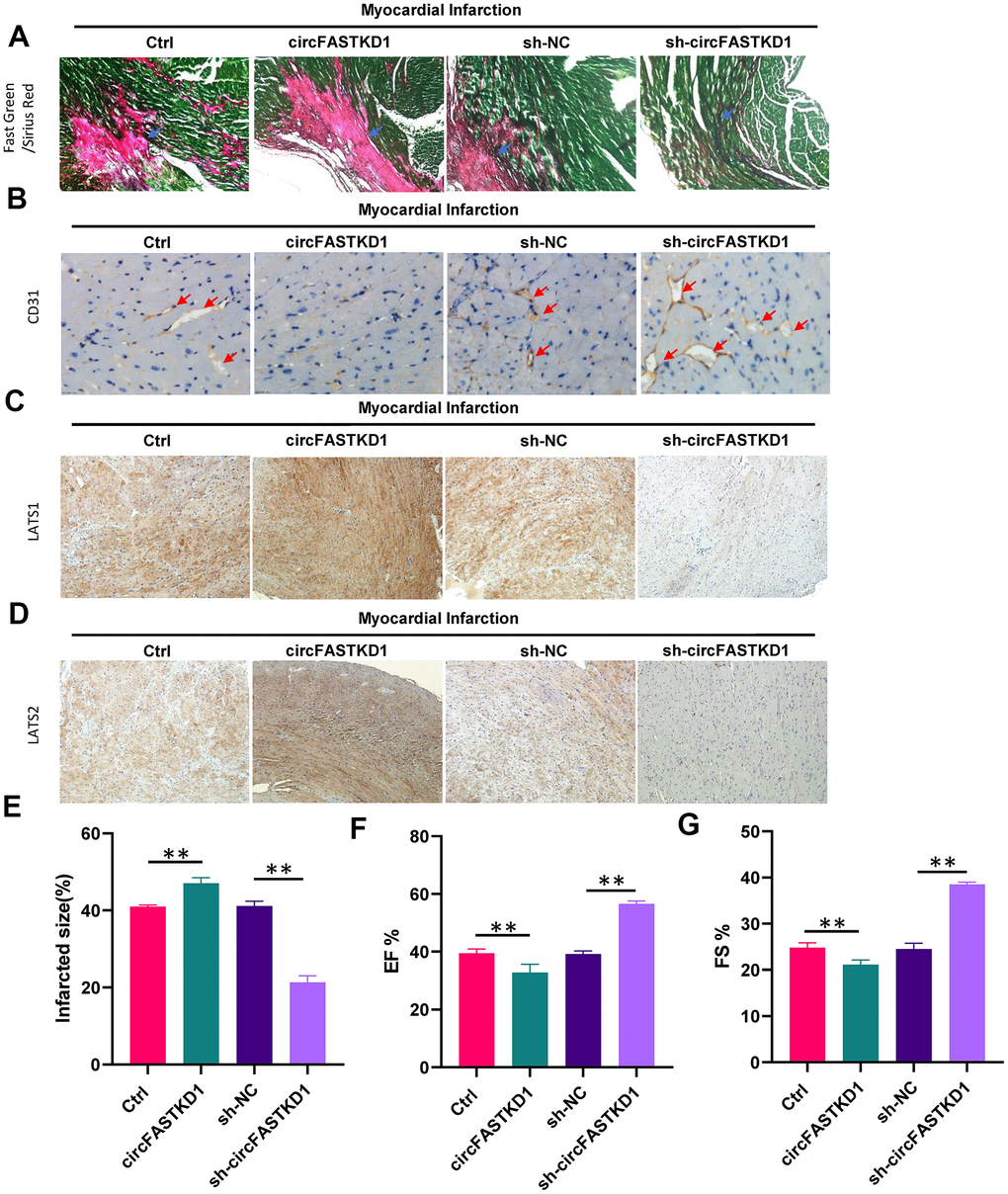 The downregulation of circFASTKD1 ameliorates myocardial infarction. (A) Fast Green and Sirius Red staining to mark the myocardium (green) and scar (red) in each group. (B) CD31 staining showing the microvessel density in each group. (C, D) Immunohistochemical staining showing the expression of LATS1 (C) and LATS2 (D) in myocardial tissue from the different groups. (E–G) Quantification of the scar size (E), left ventricular EF% (F) and left ventricular FS% (G) in the different groups. Data are presented as the mean of three experiments, and the error bars represent the SD (*P