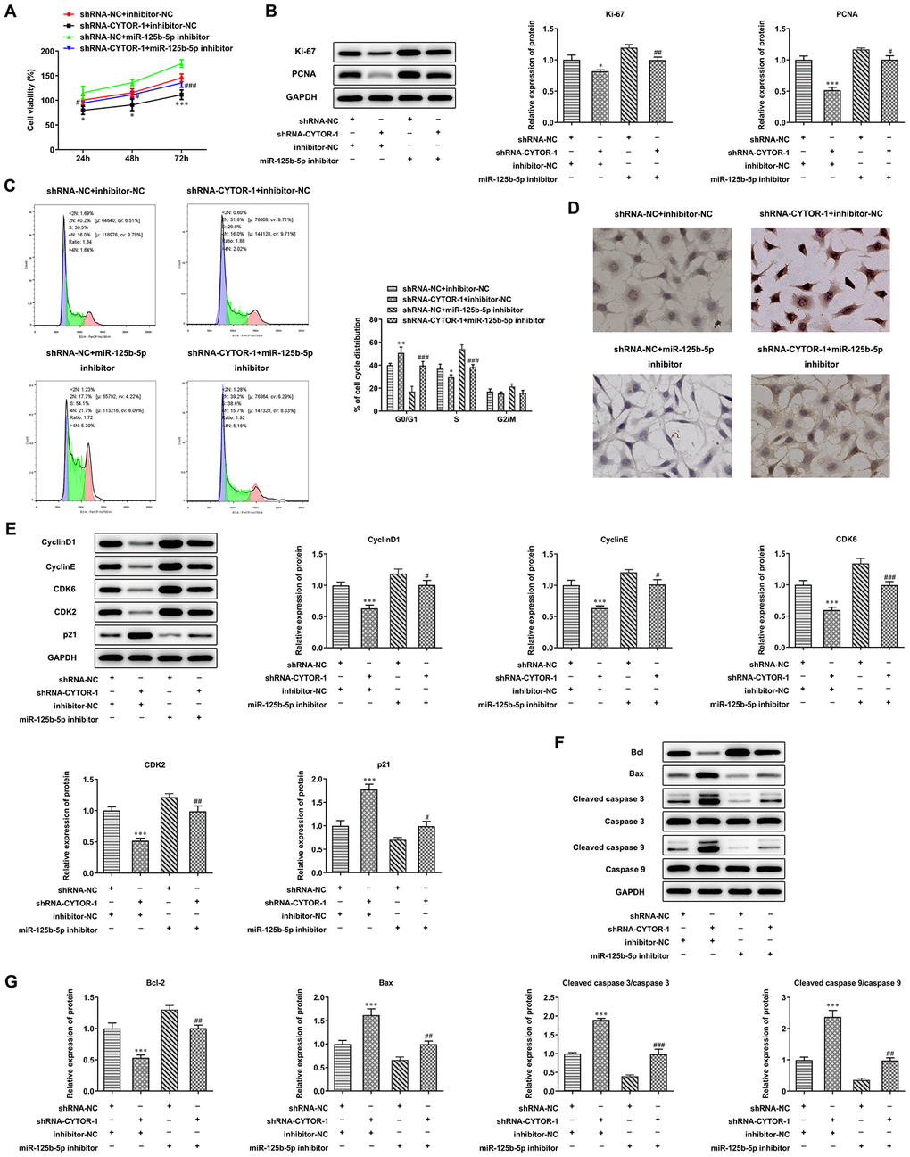 CYTOR affects proliferation, cell cycle and apoptosis of HCC cells by miR-125b-5p. (A) The proliferation of Hep3b cells after transfection of shRNA-CYTOR-1 and miR-125b-5p inhibitor was detected by CCK-8 assay. *P#P###PB) The expression of proliferation-related proteins in Hep3b cells after transfection of shRNA-CYTOR-1 and miR-125b-5p inhibitor was detected by Western blot analysis. *P#P##PC) The cell cycle of Hep3b cells after transfection of shRNA-CYTOR-1 and miR-125b-5p inhibitor was analyzed by flow cytometry analysis. *P###PD) The apoptosis of Hep3b cells after transfection of shRNA-CYTOR-1 and miR-125b-5p inhibitor was shown by TUNEL assay. (E) The expression of cell cycle-related proteins in Hep3b cells after transfection of shRNA-CYTOR-1 and miR-125b-5p inhibitor was detected by Western blot analysis. ***P#P##P###PF, G) The expression of apoptosis-related proteins in Hep3b cells after transfection of shRNA-CYTOR-1 and miR-125b-5p inhibitor was detected by Western blot analysis. ***P##P###P