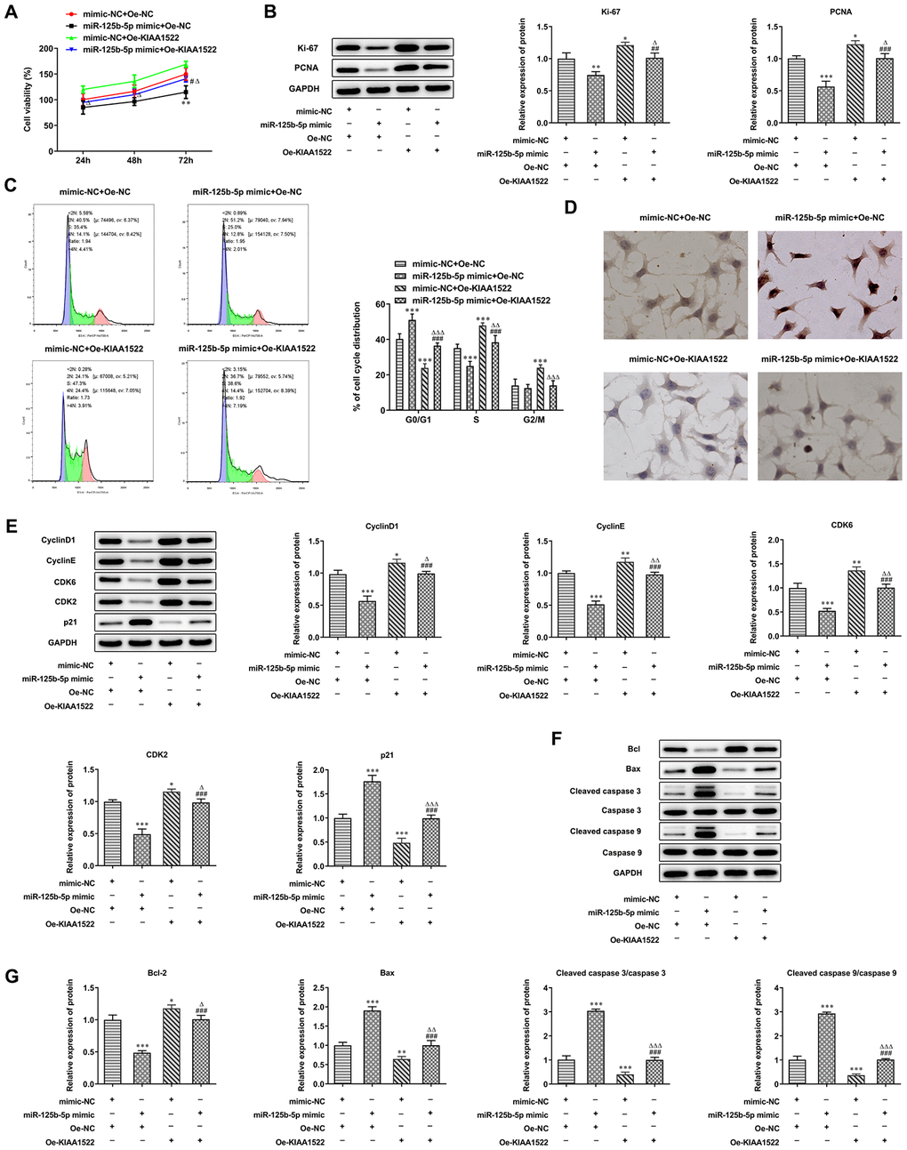 MiR-125b-5p/KIAA1522 axis affects proliferation, cell cycle and apoptosis of HCC cells. (A) The proliferation of Hep3b cells after transfection of miR-125b-5p mimic and Oe-KIAA1522 was detected by CCK-8 assay. **P#PB) The expression of proliferation-related proteins in Hep3b cells after transfection of miR-125b-5p mimic and Oe-KIAA1522 was detected by Western blot analysis. *P##P###PC) The cell cycle of Hep3b cells after transfection of miR-125b-5p mimic and Oe-KIAA1522 was analyzed by flow cytometry analysis. ***P###PD) The apoptosis of Hep3b cells after transfection of miR-125b-5p mimic and Oe-KIAA1522 was shown by TUNEL assay. (E) The expression of cell cycle-related proteins in Hep3b cells after transfection of miR-125b-5p mimic and Oe-KIAA1522 was detected by Western blot analysis. *P###PF, G) The expression of apoptosis-related proteins in Hep3b cells after transfection of miR-125b-5p mimic and Oe-KIAA1522 was detected by Western blot analysis. *P###P