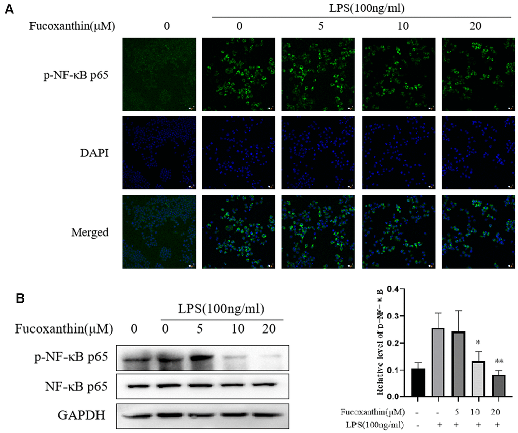 Fucoxanthin suppresses LPS-induced activation of NF-κB signaling in RAW 264.7 cells. (A) RAW264.7 cells were pretreated with the indicated concentrations of Fucoxanthin for 1 h before being stimulated with LPS for another 24 h. p-NF-κB was determined by immunofluorescence staining. DAPI-stained nuclei are indicated by blue fluorescence. NF-κB was indicated by red fluorescence, scale bar=200 μm. (B) The expression level of p-NF-κB p65 and NF-κB p65 was determined by immunoblotting. *P P 