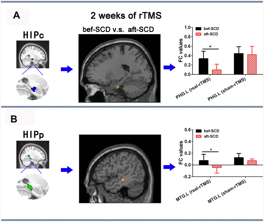 Changes in HIPsub network functional connectivity of SCD before and after 2 weeks of rTMS treatment controlling for age, sex, GM, and education. (A) HIPc seed, brain regions of HIPc functional connectivity changes, and quantitative changes on HIPc functional connectivity of SCD subjects after 2 weeks of rTMS treatment. (B) HIPp seed, brain regions of HIPp functional connectivity changes, and quantitative changes on HIPp functional connectivity of SCD subjects after 2 weeks of rTMS treatment. * p