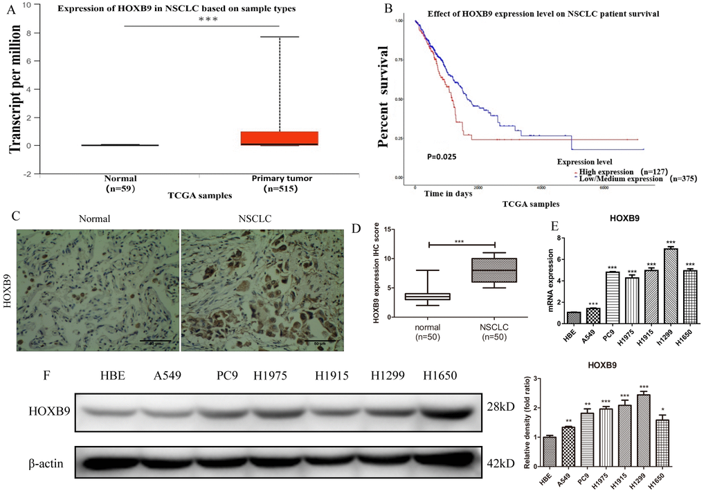 HOXB9 is highly expressed in clinical NSCLC specimens and NSCLC cell lines and correlates with shorter patient survival. (A) Analysis of HOXB9 expression in NSCLC (n = 515) and normal lung tissue samples (n = 59) retrieved from the TCGA database. HOXB9 expression was significantly higher in NSCLC specimens (pB) High-HOXB9 expression is correlated with shorter overall survival (OS) in NSCLC (TCGA data). High-HOXB9 expression group, n = 127; low-HOXB9 expression group, n = 375; P = 0.025. (C) Representative images of HOXB9 expression from IHC analysis of 50 matched NSCLC and normal lung samples. Scale bars = 50 μm. (D) IHC score-based quantification of total HOXB9 IHC data from (C); HOXB9 expression was significantly higher in NSCLC samples (pE) Relative HOXB9 mRNA expression in NSCLC cell lines and human bronchial epithelial cells (HBE). (F) Western blotting analysis of HOXB9 expression in NSCLC cell lines and HBE cells, and the gray level analysis results for western blotting; *p 