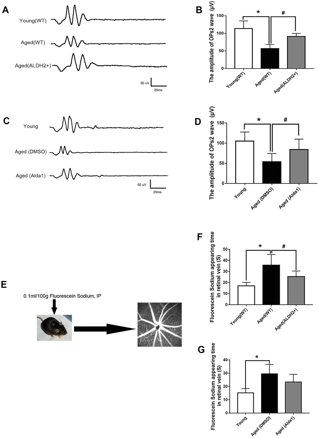 ALDH2 enhanced aged mouse retinal vessel function. (A, B) A typical OPs response image and amplification of the OPs2 response in ALDH2 overexpression mice; (C, D) A typical OPs response image and the amplification of OPs2 response in Alda1-treated mice; (E) The operation procedure pattern diagram for the FFA detection method; (F) The appearance time of fluorescein sodium in the retinal vessel in ALDH2 overexpression mice (G) and Alda1-treated mice. All analyses were performed in duplicate. Values are presented as the mean ± SD, n = 10 mice per group. *Pvs young (WT) group or aged (DMSO) group and aged (Alda1) group vs Young group; #Pvs aged (WT) group or aged (Alda1) group vs aged (DMSO) group.