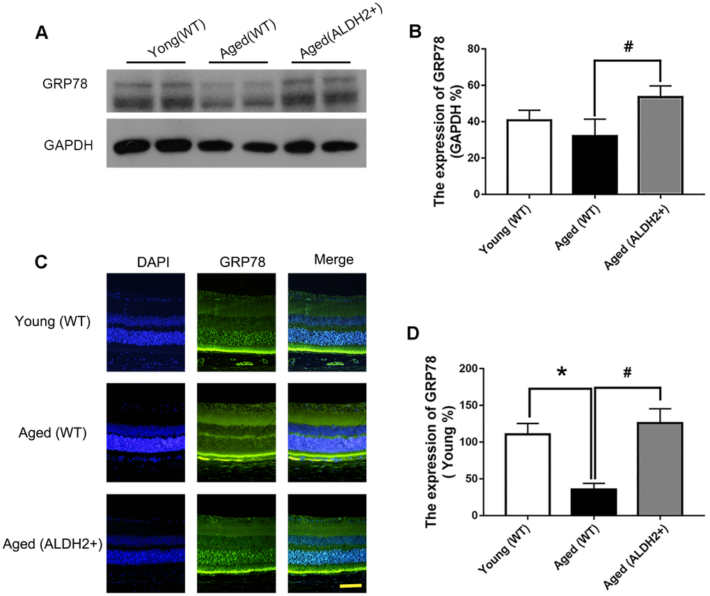 The expression of GRP78 in ALDH2+ overexpression mice during the normal aging process. (A, B) A typical WB image of GRP78 and the confirmation of GRP78 expression by WB; (C, D) A typical immunofluorescence image of GRP78 and the confirmation of GRP78 expression by immunofluorescence. All analyses were performed in duplicate. Scale bar: 50 μm. Values are presented as the mean ± SD, n = 4 mice per group. *Pvs young (WT); #Pvs aged (WT).