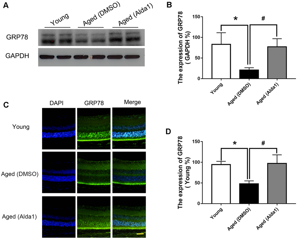 The expression of GRP78 in Alda1-treated mice during the normal aging process. (A, B) A typical WB image of GRP78 and the confirmation of GRP78 expression by WB; (C, D) A typical immunofluorescence image of GRP78 and the confirmation of GRP78 expression by immunofluorescence. Scale bar: 50 μm. All analyses were performed in duplicate. Values are presented as the mean ± SD, n = 4 mice per group. *Pvs young; #Pvs aged (DMSO).