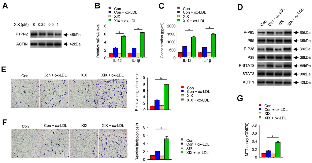 PTPN2 inhibitor XIX mimics the effects of PTPN2 deletion in THP-1 cells. (A) Expression of PTPN2 in THP-1 cells with different concentration of XIX were detected by IB assay. (B) mRNA levels of IL-12 and IL-1β in THP-1 cells were analyzed by qRT-PCR assay. (C) ELISA assay was used to analyze the production of IL-12 and IL-1β in THP-1 cells in the presence of XIX or ox-LDL. (D) Indicated proteins in THP-1 cells were detected by IB assay. (E, F) Transwell migration and invasion assays were performed in THP-1 cells. Bar= 20μM. (G) MTT assay was used to analyze the viability of HUVEC cell after incubated with THP-1 cells. Data are representative of at least three independent experiments and are presented as mean ± SD. ns, not statistically significant; *, P 