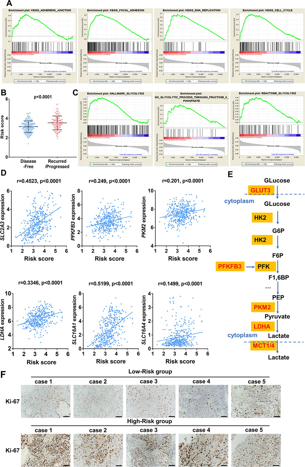 Enrichment analysis of cancer and glycolysis related pathways associated with risk score in TCGA-BLCA database. (A) Gene set enrichment analysis (GSEA) on the association of risk score with adherens junction, focal adhesion, cell cycle and DNA replication. (B) Risk score of UBC patients with disease free and progression/recurrence in TCGA-BLCA dataset. (C) GSEA plots depicting enrichment of glycolysis pathways and risk score. (D) The correlation between the expression of glycolytic genes and the risk score. (E) The identified core candidate genes (red) involved in enzymatic glycolysis are shown. (F) The representative IHC images of ki-67 expression in UBC tissues with low- or high-risk.