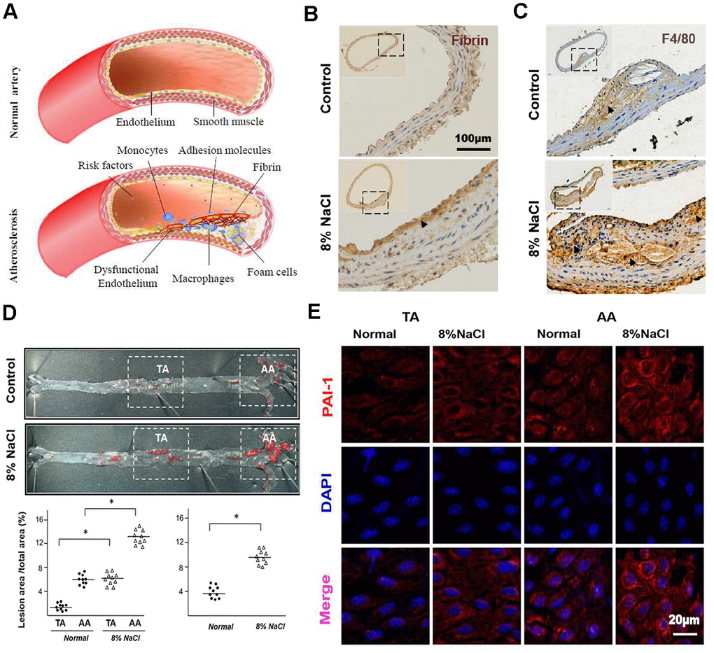 High-salt intake predisposes fibrin deposition, macrophage infiltration and atherosclerosis formation in aortas of ApoE-/- mice. (A) The schematic diagram shows the process of fibrin deposition, macrophage infiltration and atherosclerosis formation. (B, C) Representative sections of the AA region in ApoE-/- mice stained for fibrin and macrophage marker F4/80 (n = 7). Nuclei, hematoxylin staining. Fibrin and F4/80-positive macrophages were marked respectively by arrow heads. (D) Oil Red O staining of the artery and quantification of percentage lesion areas in the thoracic aorta (TA) and aortic arch (AA) of ApoE-/- mice (n = 10) fed with a normal or high-salt diet for 12 weeks. (E) En face immunofluorescent staining of PAI-1 (red) in ECs of TA and AA regions of ApoE-/- mice in normal and high salt groups after 4 weeks feeding. Nuclei were stained by DAPI. All data were presented as mean ± SEM, N≥7. *p 