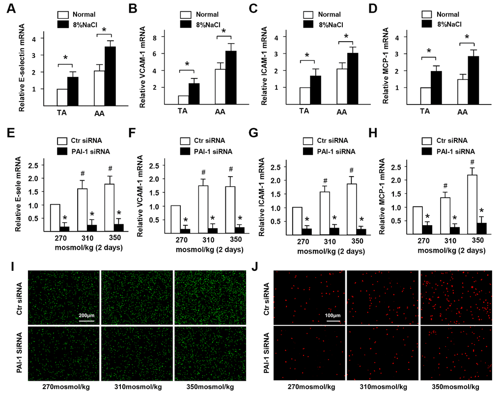 High-salt promotes adhesion molecules expression and inflammatory cells infiltration in ECs via PAI-1. (A–D) mRNA expression of adhesion molecules (E-selectin, VCAM-1, ICAM-1, and MCP-1) in TA and AA regions of ApoE-/- mice in normal and high salt groups after 4 weeks feeding. (E–H) mRNA expression of adhesion molecules (E-selectin, VCAM-1, ICAM-1, and MCP-1) in HUVECs that were treated with Ctr siRNA or PAI-1 siRNA under high-salt condition for two days. (I) Representative images of adherent monocytes to HUVECs that were treated with Ctr siRNA or PAI-1 siRNA under high-salt condition. (J) Representative images of infiltrated monocytes into HUVECs that were treated with Ctr siRNA or PAI-1 siRNA under high-salt condition. All data were presented as mean ± SEM, N≥3. *p 