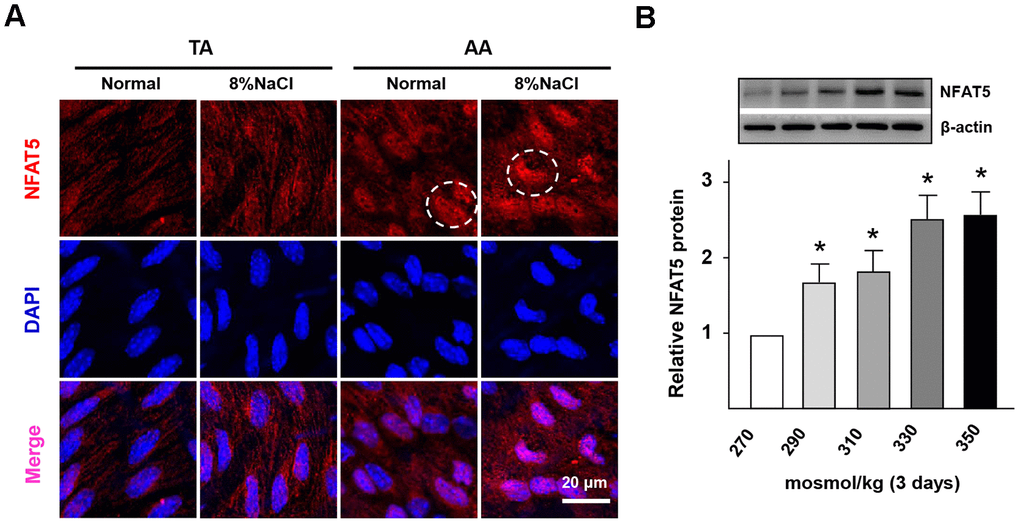 High-salt intake induces NFAT5 nuclear translocation in ECs. (A) En face immunofluorescent staining of NFAT5 (red) in ECs of TA and AA regions of ApoE-/- mice in normal and high salt groups after 4 weeks feeding. Nuclei were stained by DAPI. NFAT5 nuclear translocation in ECs was marked by circles. (B) Protein expression of NFAT5 in HUVECs that exposed to different hyper-osmotic media for three days. All data were presented as mean ± SEM, N≥3. *p 