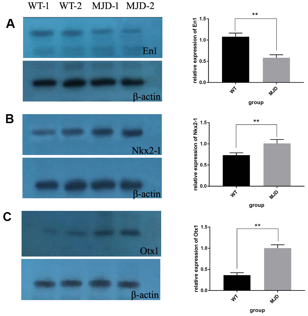 Protein levels of En1, Nkx2-1, and Otx1 in 32-week old mice cerebellum. (A) Western blot analysis of En1 in both control and SCA3/MJD groups. Compared to control group, the protein level of En1 was significantly downregulated in SCA3/MJD group (pB) Western blot analysis of Nkx2-1 in both control and SCA3/MJD groups. Compared to control group, the protein level of Nkx2-1 was significantly upregulated in SCA3/MJD group. (C) Western blot analysis of Otx1 in both control and SCA3/MJD groups. Compared to control group, the protein level of Otx1 was significantly upregulated in SCA3/MJD group.