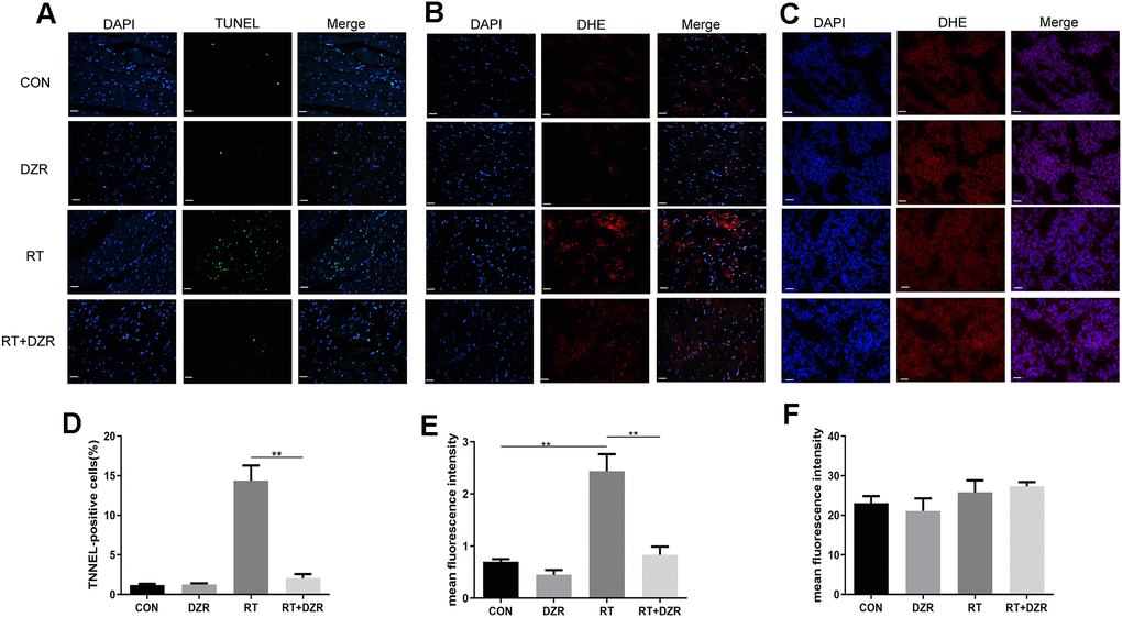 Effect of DZR on post-radiation ROS generation in heart and tumor tissue. (A, D) show typical TUNEL-stained photomicrographs of heart tissues (×400, n=7–11 respectively). TUNEL- and DAPI-positive cells appear green and blue, respectively. Myocardial cell apoptosis increased markedly in RT rats compared to other groups. (B) Representative images of dihydroethidium (DHE) fluorescence staining (×400) of rat cardiomyocytes. DHE=red, nuclei=blue. (E) Quantitative analysis of ROS (n=5 per group) in rat heart tissues. (C) Representative microphotographs of DHE staining (×400) in tumor tissues from nude mice. (F) No differences in DHE fluorescence density of tumor tissues were observed in quantitative analysis (n=5 per group). mean ± SEM, *: p p 