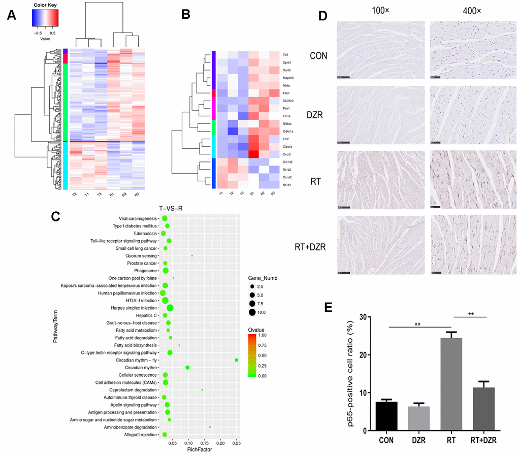 Gene expression profile in heart tissue from the RIHD rat model. (A) Results of transcriptome sequencing of tissue samples from RT and RT+H-DZR rats. (B) Gene expression profiles of Toll-like signaling pathway members were examined using a heat map. Red, high expression; white, intermediate expression; blue, low expression. (C) Top 30 enriched pathways identified using distribution points of differential genes in KEGG pathway analysis. The horizontal axis represents the enrichment factor, point size indicates the number of differential genes in the pathway, and the color of the points corresponds to different Q-value ranges. T indicates RT+H-DZR, R indicates RT. (D, E) show NF-κB-p65 protein levels (×100, scale bar =250 μm; ×400, scale bar =50 μm) in myocardial tissue determined by immunohistochemistry (n=5 per group). mean ± SEM, *: p p 