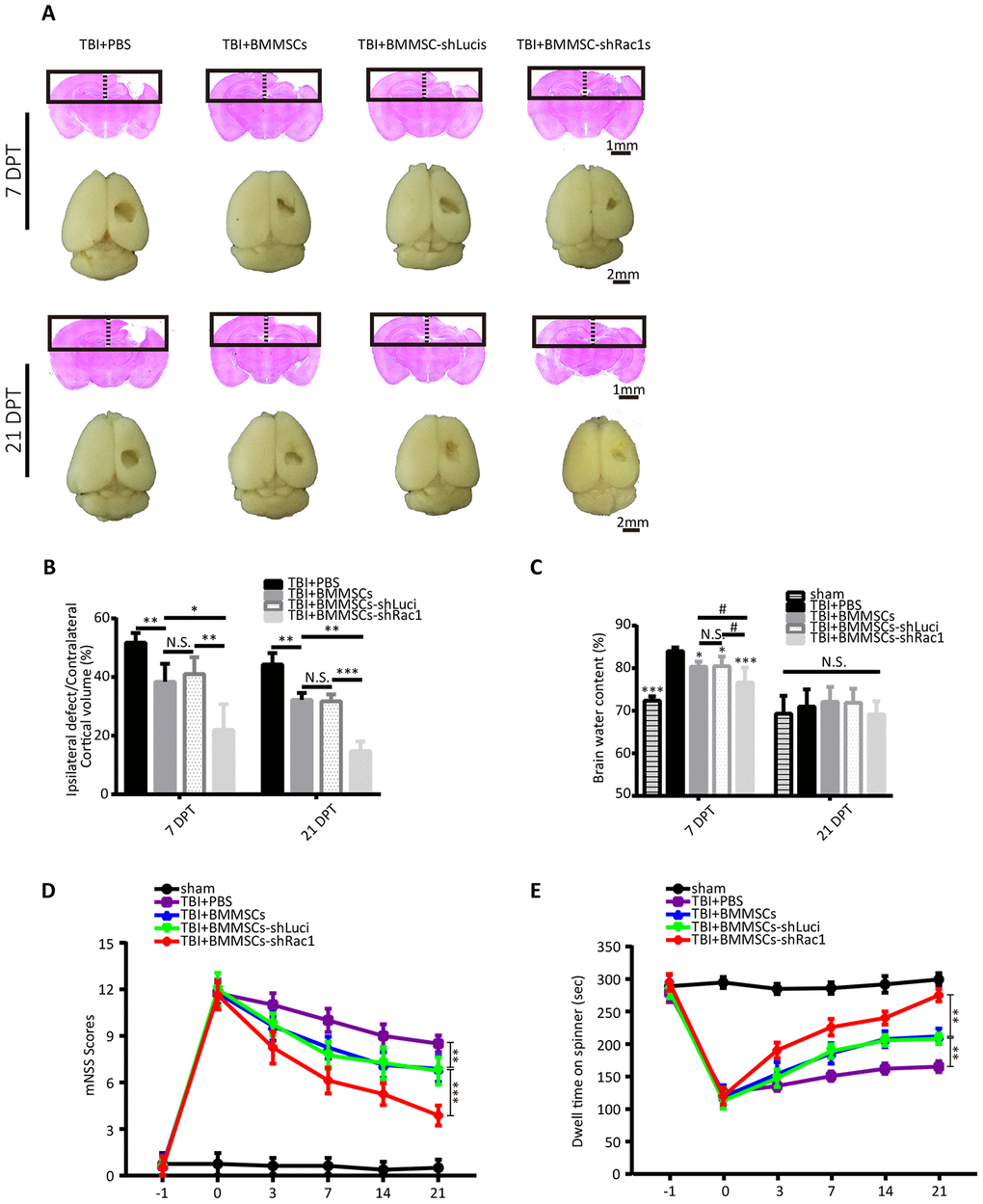 Transplanting BMMSCs-shRac1 promotes the recovery of neurological functions and reduces brain edema after TBI. (A) Images displaying the whole brain and ipsilateral TBI brain stained with H&E 7 days and 21 days after BMMSCs (parental BMMSCs, BMMSCs-shLuci, BMMSCs-shRac1) transplantation or after PBS injection. The scale bar of 1 mm and 2 mm is indicated, respectively. (B) Quantification of lesional volume in the BMMSCs-transplanted versus placebo (PBS) mice. The lesional size was smallest in BMMSCs-shRac1 transplanted mice at 7 days post transplantation (DPT) and 21 DPT. (N.S. no significance, *P C) Quantitative analysis of brain moisture content in each group. Mice treated with parental BMMSCs, BMMSCs-shLuci, and BMMSCs-shRac1 had less edema compared with PBS injection group at 7 DPT, with the BMMSCs-shRac1 group showing minimal edema. No significance was found at 21 DPT. (N.S. no significance, #P D) mNSS scores for mice treated with PBS, parental BMMSCs, BMMSCs-shLuci, or BMMSCs-shRac1, with the latter achieving the lowest score. (**P E) Rotarod test of mice treated with PBS, parental BMMSCs, BMMSCs-shLuci, or BMMSCs-shRac1, where the latter achieved the maximum stay-on time at each time point after transplantation (**P 