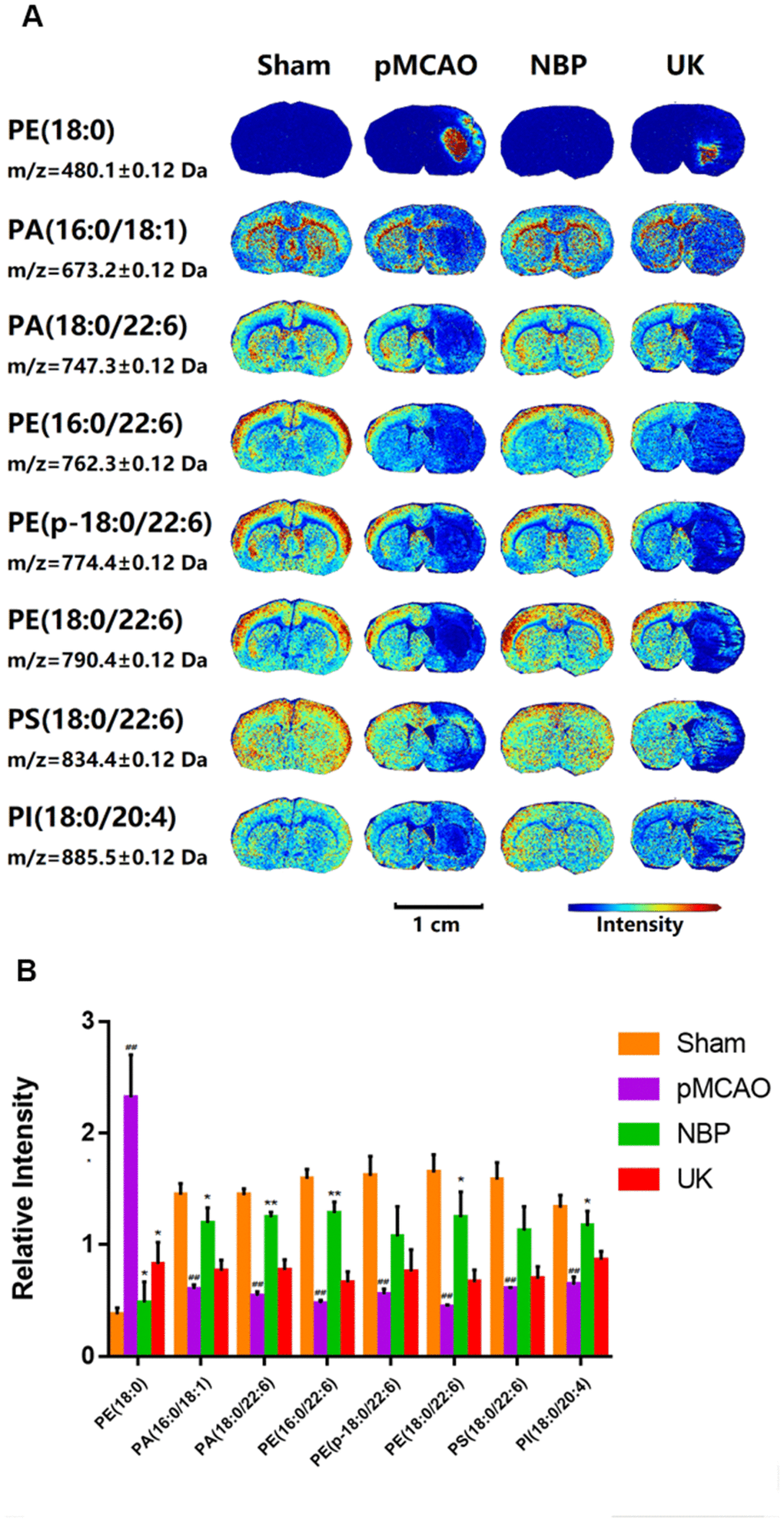 Changes in phospholipid levels in the brains of rats with pMCAO. (A) In situ MALDI-TOF MSI of phosphatidylethanolamine (PE) (18:0), phosphatidic acid (PA) (16:0/18:1), PA (18:0/22:6), PE (16:0/22:6), PE (p-18:0/22:6), PE (18:0/22:6), phosphatidylserine (PS) (18:0/22:6) and phosphatidylinositol (PI) (18:0/20:4). The spatial resolution was set to 100 μm. Scale bar = 1 cm. (B) Statistical analysis of the relative intensities of the phospholipids mentioned above. Values were normalized to those in the left brain where there was no ischemia. The data are presented as the mean ± SD, n = 3, and were assessed using one-way ANOVA. ## P P P 
