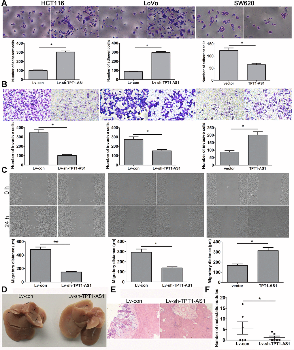 TPT1-AS1 promotes CRC cell migration and invasion in vitro and vivo. (A) Cell adhesion assay was applied to determine the effect of TPT1-AS1 on CRC cell adhesion (magnification 200x). Wound scratch (magnification 100x) (B) and Transwell assays (magnification 200x) (C) were performed to examine the effect of TPT1-AS1 on CRC cell invasion and migration. (D) TPT1-AS1 knockdown suppressed CRC liver metastasis in vivo, the gross specimen images of liver metastases. (E) The metastatic nodules in liver tissue were detected by HE staining (magnification 100x). (F) The statistical analysis of number of liver metastatic nodules. *PP 