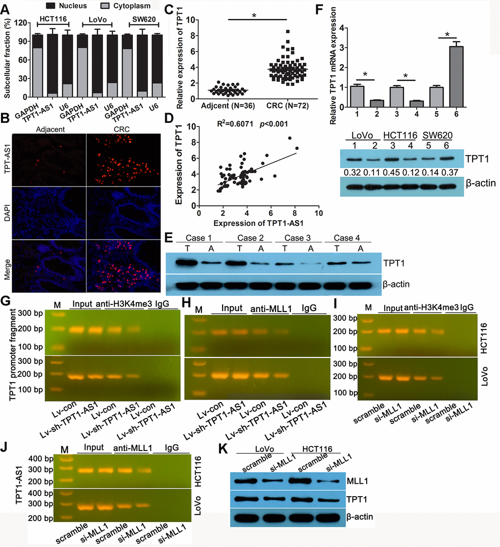 TPT1-AS1 upregulated the expression of TPT1 by H3K4me3 modification. (A) Subcellular fractionation analysis showed that TPT1-AS1was mainly enriched in the nucleus of CRC cells. (B) FISH analysis the subcellular localization of TPT1-AS1 in tissues (magnification 100x). (C) qRT-PCR detected TPT1 expression in 72 CRC and 36 adjacent normal tissues. (D) The correlation between TPT1-AS1 and TPT1 expression was analyzed in 72 CRC tissues. (E) Western blot showed that our CRC specimen had a obviously increased TPT1 level compared with adjacent normal tissues. (F) TPT1 mRNA (upper)and protein (down) level were examined in TPT1-AS1 overexpression and knockdown cells. (G) ChIP assay showed that TPT1-AS1 depletion reduced the H3K4me3 modification in TPT1 transcription region. (H) ChIP analysis reveals that MLL1 mediated TPT1-AS1 regulation TPT1 transcription. (I) ChIP analysis demonstrated that H3K4me3 level was reduced in the TPT1 promoter region after MLL1 depletion. (J) RIP assays confirmed that TPT1-AS1 could physically bind to MLL1. (K) TPT1 expression was impeded when MLL1 was silenced by siRNA. 1,3 stand for Lv-con group; 2,4 stand for Lv-sh-TPT1-AS1 group; 5 stand for vector group; 6 stand for TPT1 overexpression group. *P