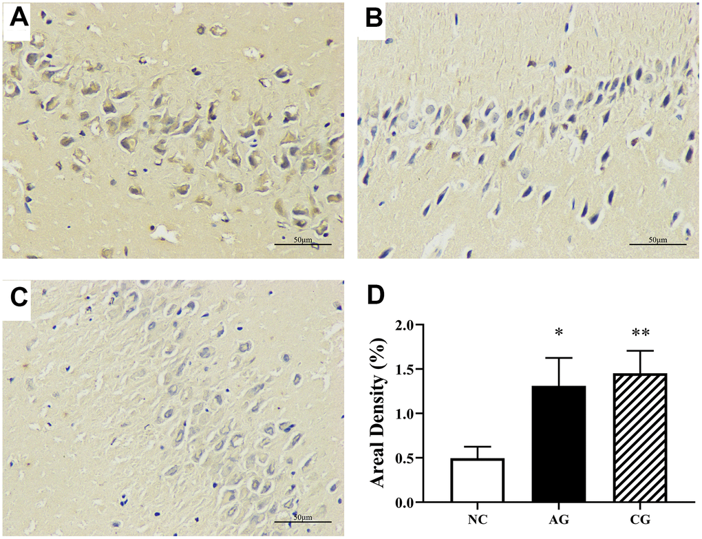 Hippocampal immunohistochemical analysis of the negative control group (A), the aging group (B) and the constipation group (C) under an optical microscopy (400 × magnification) and their semi-quantification (D). Data were presented as the mean ± S.E. (n=3).