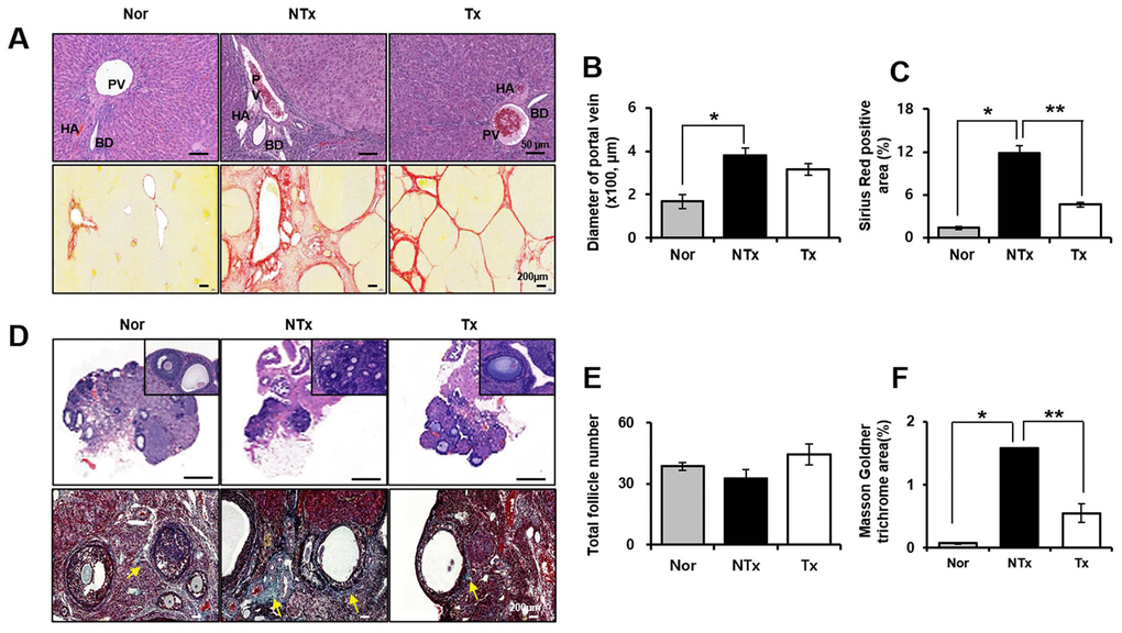 Histological analysis in TAA-injured rat model. H&E (A, upper) and Sirius red (A, lower) was stained and quantification (B, C) from liver in TAA-injured rat model (20x magnification). H&E (D, upper) and Masson Goldner trichrome (D, lower) was stained and quantification (E, F) from ovary in TAA-injured rat model (x20 magnification). Data represent the mean ± S.D. * Significantly different versus Normal (*p