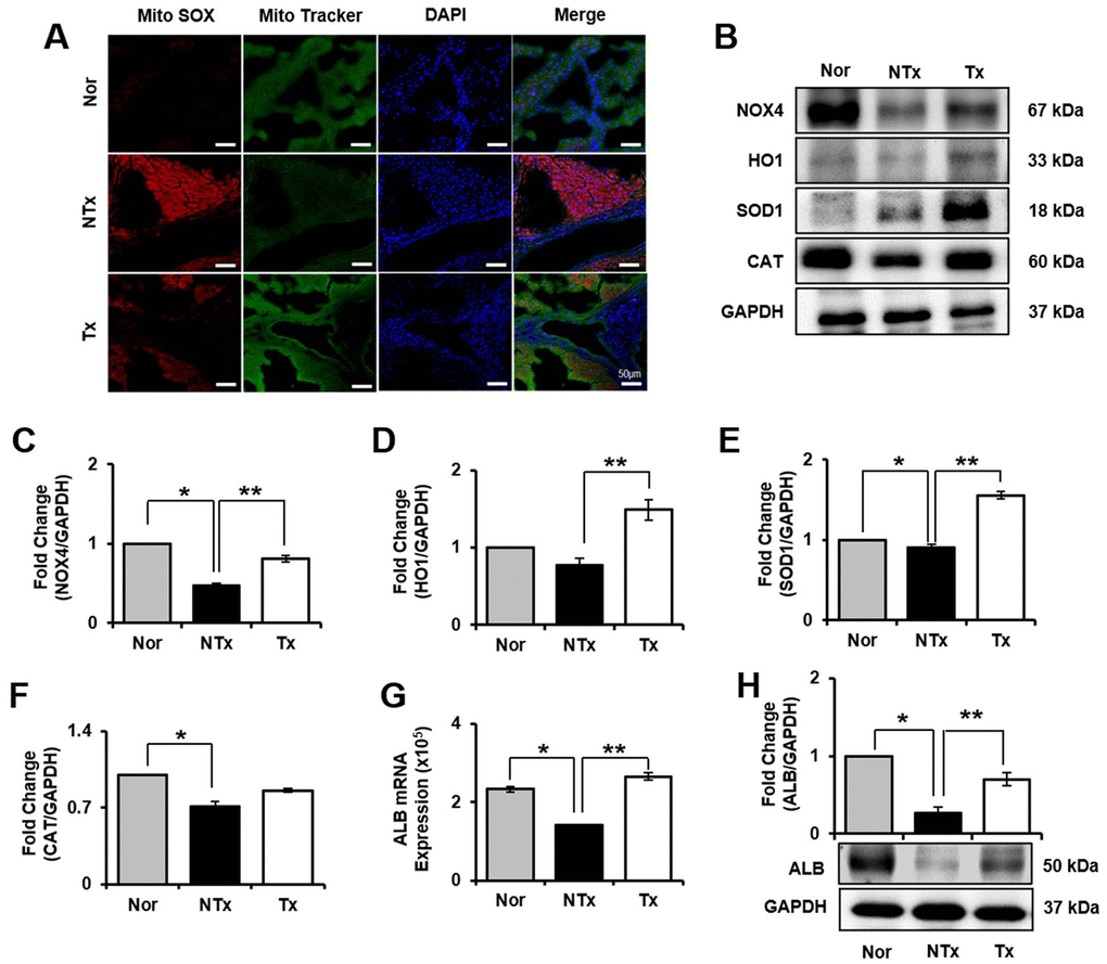 Effect of antioxidant of PD-MSCs in liver of TAA-injured rat model. Mito SOX and Mito Tracker were stained on liver of TAA-injured rat model by immunofluorescence (A). The gene expression related to antioxidants were evaluated in liver of TAA-injured rat model by western blot (B). Changes in protein levels are expressed (bar histogram) as band density normalized versus GAPDH (C–F). The Albumin expression of mRNA (G) and protein (H) were analyzed in liver of TAA-injured rat model by qRT-PCR and western blot. Data represent the mean ± S.D. * Significantly different versus Normal (*p). ** Significantly different versus NTx (**p).