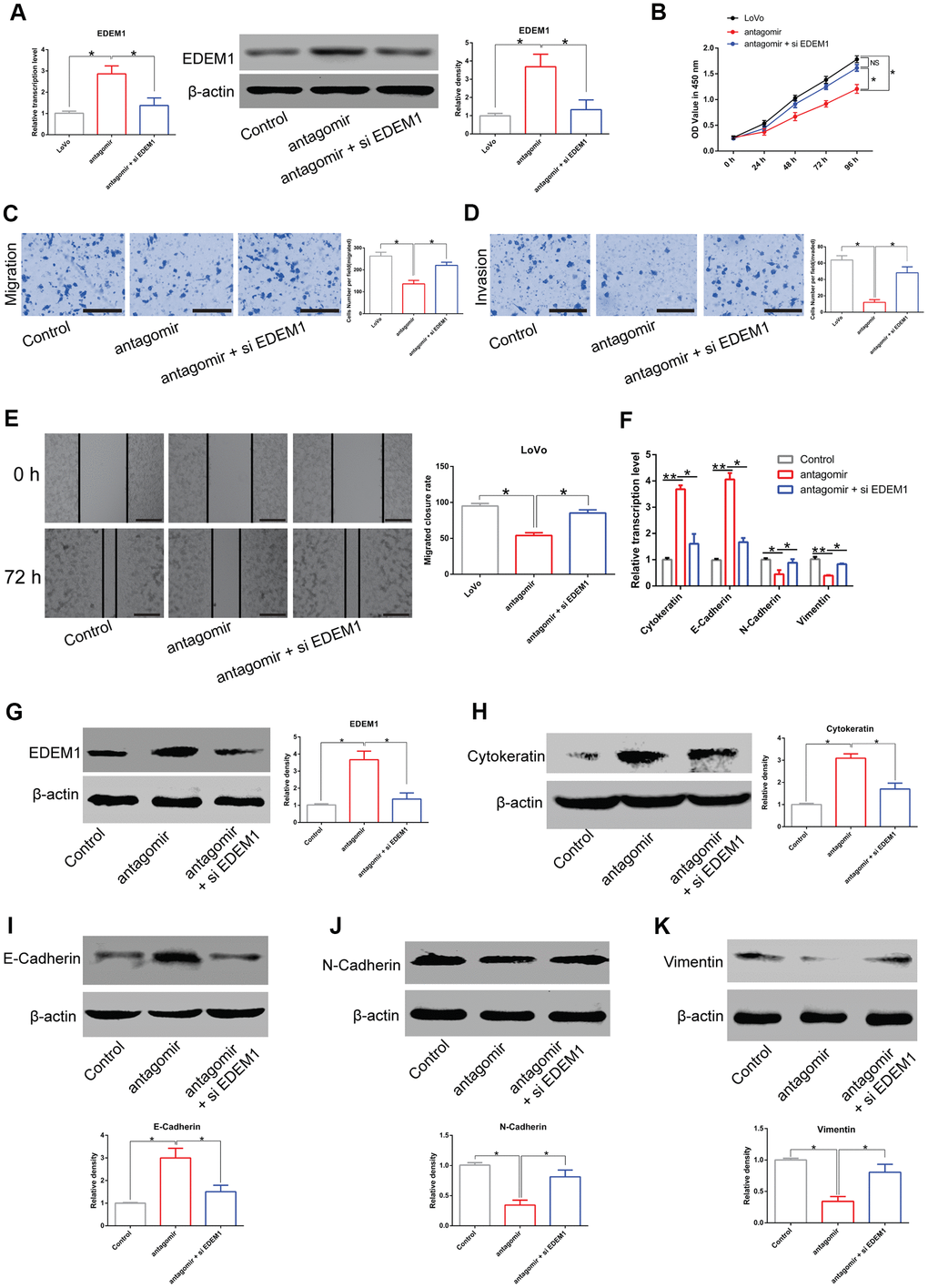 LINC00485/miR-581/EDEM1 axis regulates epithelial to mesenchymal transition in CRC cells. (A) The expression of EDEM1 in LoVo cells transfected with miR-581 antagomir or in combination with siEDEM1. (B) Cell viability of LoVo cells transfected with miR-581 antagomir or in combination with siEDEM1 measured by the CCK-8 assay. (C–E) The (C, E) migratory and (D) invasive capabilities of LoVo cells transfected with miR-581 antagomir or co-transfected with miR-581 antagomir and siEDEM1 were assessed by Transwell migration and invasion assays and the in vitro scratch assay. (F) The mRNA levels of cytokeratin, E-cadherin, N-cadherin, and vimentin in LoVo cells transfected with miR-581 antagomir or in combination with siEDEM1 were measured by RT-qPCR. (G–K) The protein levels of (C) EDEM1, (D) Cytokeratin, (E) E-cadherin, (F) N-cadherin and (G) Vimentin in LoVo cells transfected with miR-581 antagomir or in combination with siEDEM1 were quantified by western blotting assay. Data were analyzed using one-way ANOVA with LSD test. Bars were represented as S.D. *PP