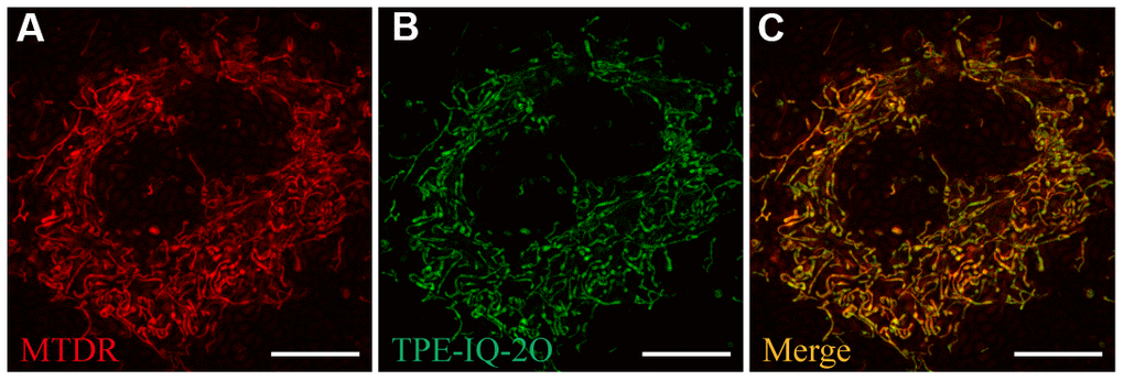Ultra-high-resolution fluorescence imaging of A549 cells. (A) MTDR staining (50 nM). (B) TPE-IQ-2O (200 nM) staining. (C) Merged image of panels (A) and (B). λex: 650 nm (MTDR) and 488 nm (TPE-IQ-2O); scale bar =10 μm.
