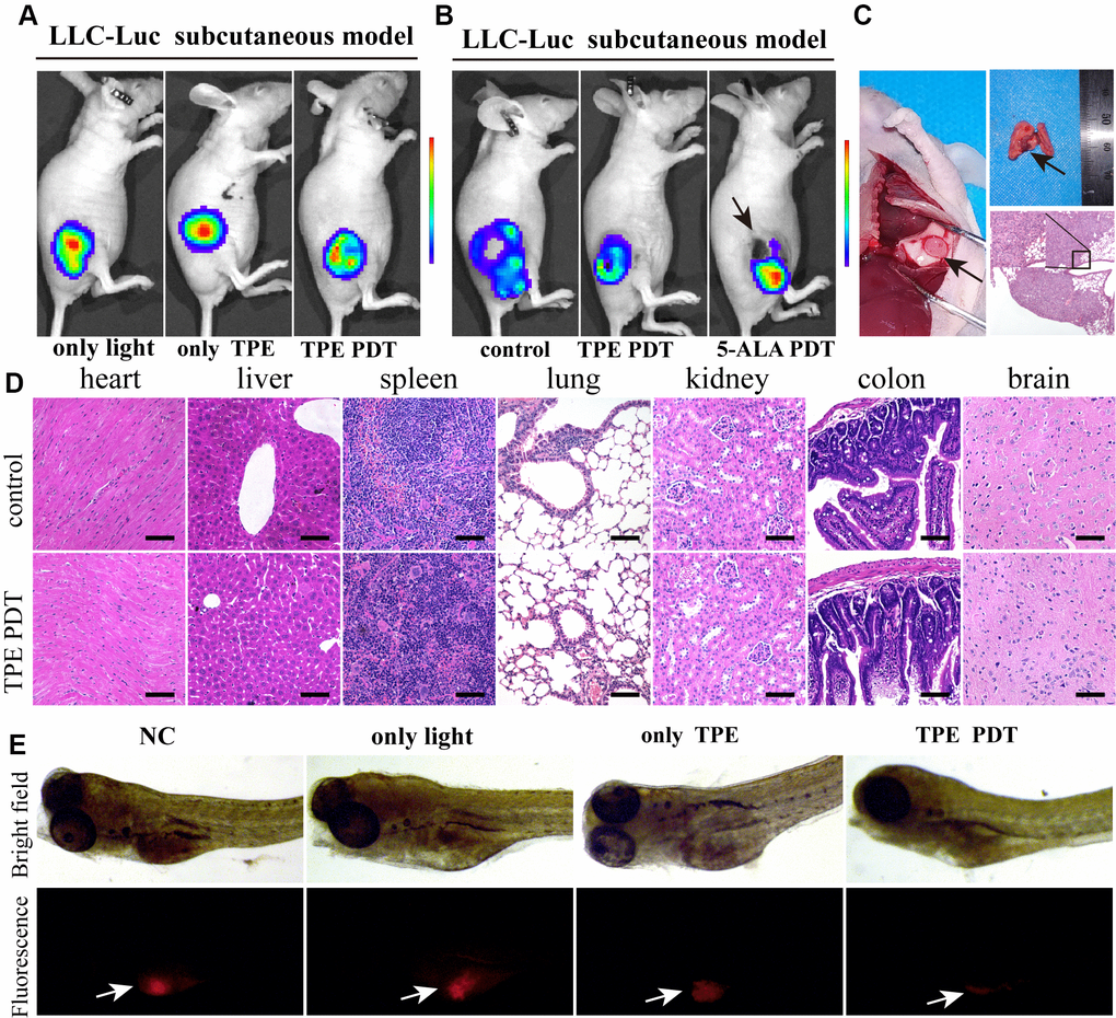 TPE-IQ-2O has a relatively strong PDT effect in vitro. (A) The killing effect of TPE-IQ-2O as a photosensitizer on tumor tissue requires exposure to light. (B) In vivo small animal imaging was performed on day 7 after TPE-IQ-2O PDT or traditional 5-ALA PDT. The black arrow shows burned skin and tumor festering. (C) The anatomical findings for metastatic lung cancer after 5-ALA PDT (Day 14, indicated by the black arrow) and pathological HE staining are shown. (D) Representative images of HE staining of tissue samples from the TPE-IQ-20 PDT group and control group are shown, scale bar = 50 μm. (E) TPE-IQ-2O was performed with/without white light (5 W, 85 mW/cm2) irradiation in a zebrafish mCherry+ A549 cell xenograft model. (TPE represents the abbreviation of TPE-IQ-2O in this figure.)