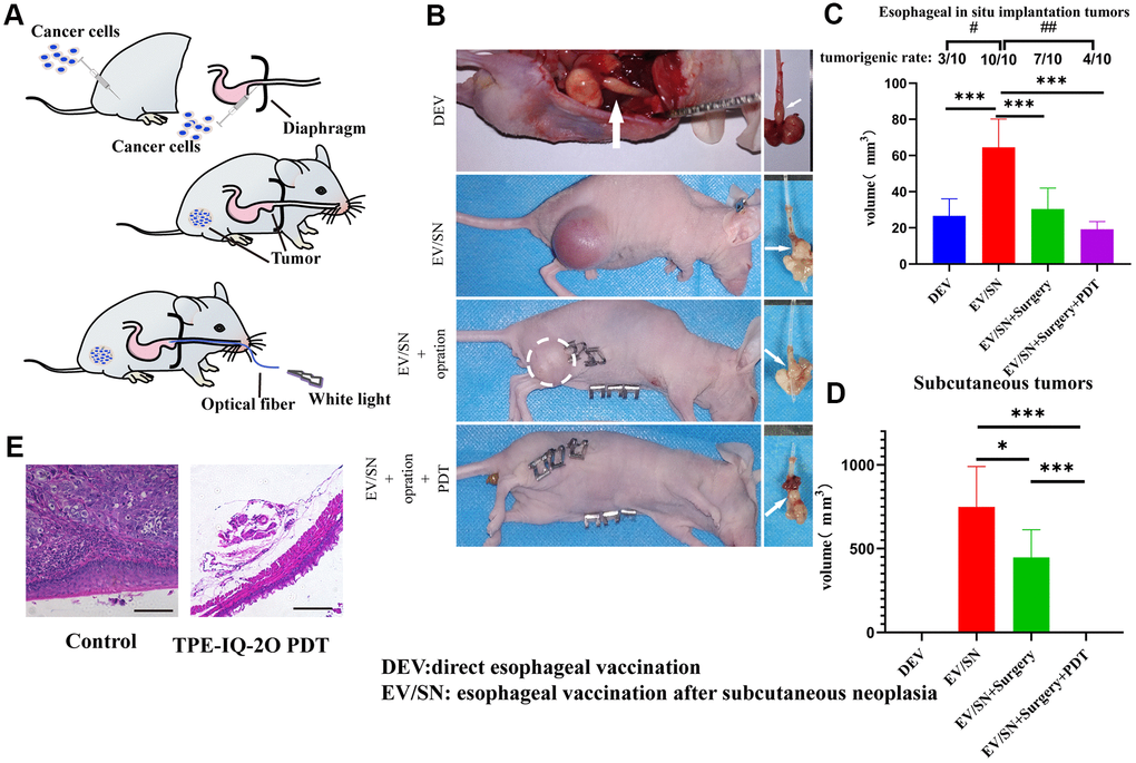 TPE-IQ-2O PDT combined with surgery can reduce the tumor formation rate, size of orthotopically implanted esophageal carcinoma and primary tumor recurrence of subcutaneous tumors. (A) Schematic diagram of subcutaneous tumorigenesis, esophageal orthotopic tumor implantation and transesophageal PDT in nude mice. (B) Gross dissection specimens of the DEV group, EV/SV group, EV/SV surgery group, and EV/SV surgery combined with PDT group (the white circle indicates the recurrent focus at the incision, and the white arrow shows the esophageal tumor in situ). (C, D) Volumes of the subcutaneous tumor and implanted esophageal tumor in each group (volume = 1/2 long diameter×short diameter2; B, C and (D) show data for day 14 after tumor reduction with PDT administered every three days for 15 minutes each time, #P P P P E) HE staining of implanted orthotopic esophageal tumors treated with or without TPE-IQ-2O PDT.