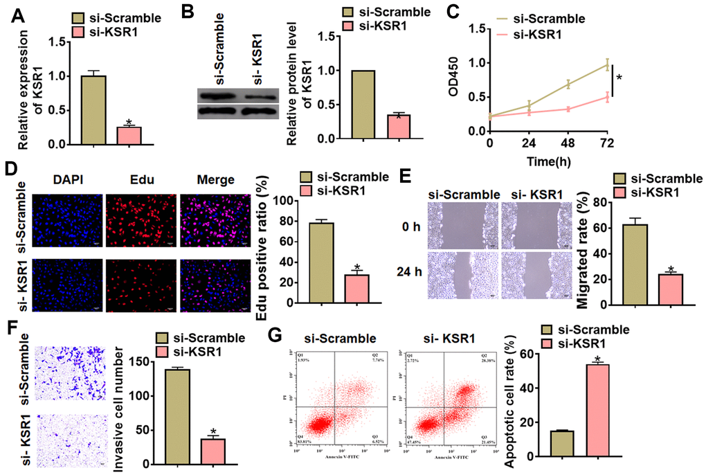 Silencing of KSR1 inhibited the progression of GC cells. (A) The silencing efficiency of si-KSR1 in MKN-45 cells. (B) Western blot was to measure the protein level of KSR1 in MKN-45 cells. (C) CCK8 was to determine the viability of MKN-45 cells. (D) Edu assay was to detect proliferation of MKN-45 cells. Scale bar, 40 μm. (E) Wound healing assay was to evaluate migration of MKN-45 cells. Scale bar, 60 μm. (F) Transwell assay was to examine invasion of MKN-45 cells. Scale bar, 60 μm. (G) Flow cytometry assay was to determine apoptosis of MKN-45 cells. Data are mean ± SD; *P 