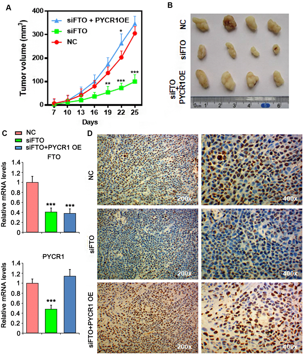 PYCR1 promotes FTO-deficient xenograft tumor growth. (A) Tumor growth curves as recorded by measuring tumor volume. (B) Xenograft tumor morphology. (C) qPCR determining FTO and PYCR1 expression in xenograft tumor. (D) Ki67 immunohistochemistry on xenograft tumor sections. NC, negative control. OE, overexpression.