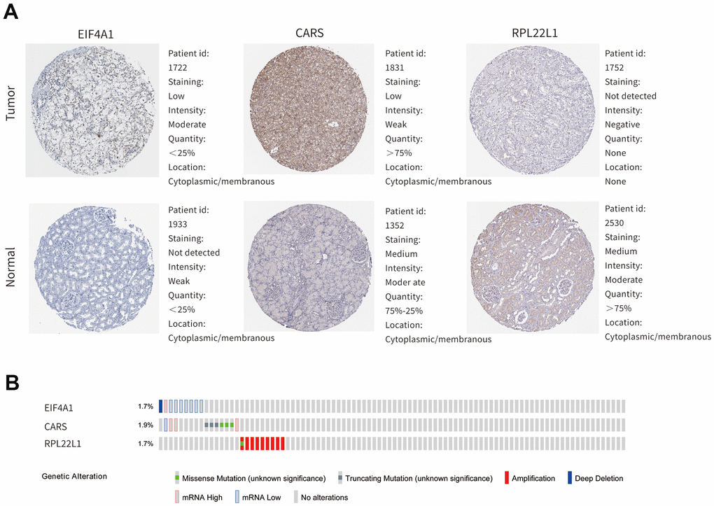 The expression profiles of hub genes in online bioinformatics databases. (A) The protein expression of hub genes in normal renal tissue and ccRCC on the HPA database. (B) Alterations of the hub genes on the cBioportal database.