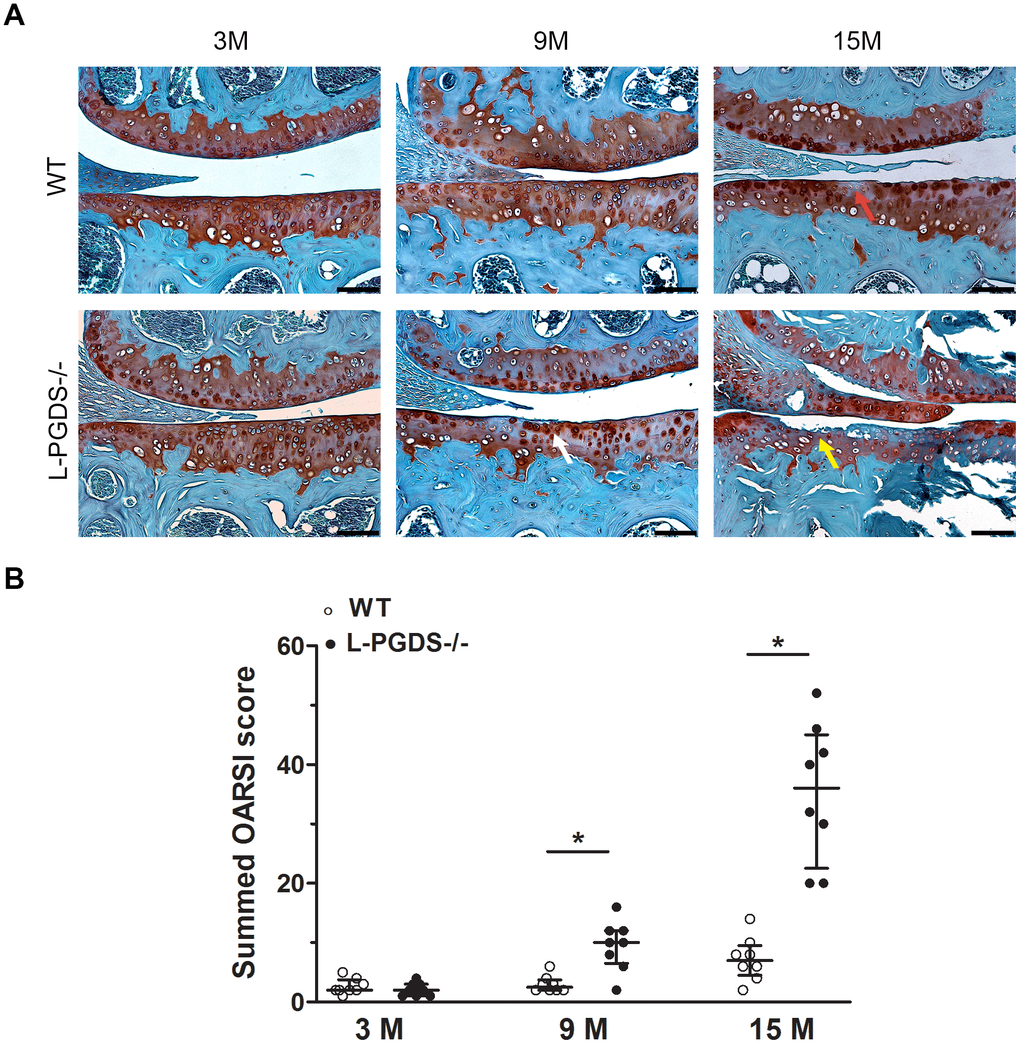 Deletion of L-PGDS accelerated cartilage erosion with age. (A) Coronal sections of whole knee joints from WT and L-PGDS-/- mice at ages 3, 9 and 15 months (n=8 mice/genotype/time point) were prepared and stained with Safranin O–fast green to assess the integrity of articular cartilage. The representative sections were selected based on the average score from each experimental group. Red arrow indicates loss of Safranin O staining. White arrow indicates areas of fibrillation and clefts. Yellow arrow indicates cartilage erosion. Scale bars=100 μM. (B) Summed histologic scores of knee cartilage from WT (open symbols) and LPGDS-/- (filled symbols) mice as determined using the OARSI scoring system. Results are presented as median with interquartile range. *P