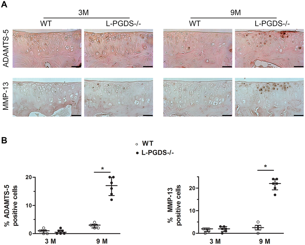 L-PGDS deficiency enhanced MMP-13 and ADAMTS-5 expression in cartilage with age. Knee joint sections from 3- (n=6 mice per genotype) and 9-month-old mice (n=6 mice per genotype) were analyzed by immunohistochemistry for MMP-13 and ADAMTS5 as described in the Materials and Methods section. (A) Representative images of immunohistochemical staining for ADAMTS5, and MMP-13 in knee joints from L-PGDS-/- and their WT littermates at 3 and 9 months of age. Scale bars=100 μm. (B) Percentage of chondrocytes expressing ADAMTS5, and MMP-13 in WT (open symbols) and L-PGDS-/- (filled symbols) mice. Data are presented as median with interquartile range of each group. *p