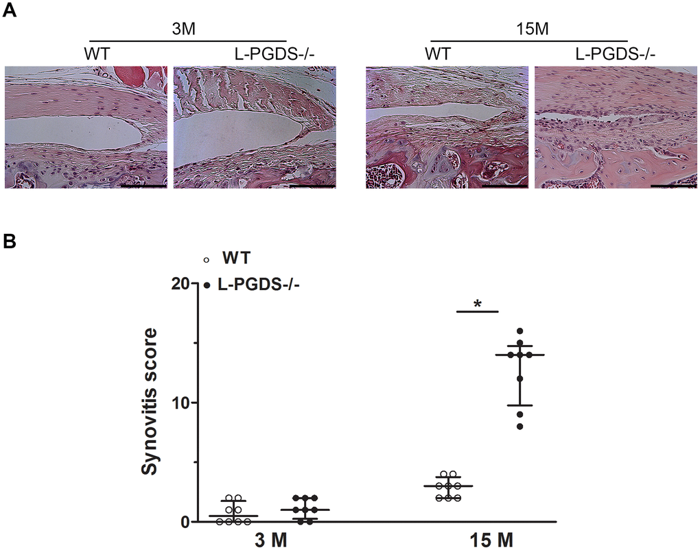 Deletion of L-PGDS increased synovitis in aged L-PGDS-/- mice. Coronal sections of whole knee joints from WT and L-PGDS-/- mice at ages 3, 9 and 15 months (n=8 mice/genotype/time point) were prepared and stained with hematoxylin and eosin to asses synovium changes. (A) Representative hematoxylin and eosin staining, and (B) summed synovitis scores of WT (open symbols) and L-PGDS-/- (filled symbols) mice at ages 3, 9, and 15 months. Scale bars=100 μm. The representative sections were selected based on the average score from each experimental group. Results are presented as median with interquartile range. *p