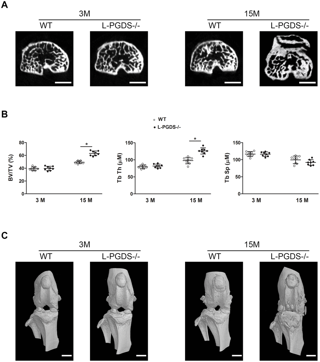 Micro-CT analysis of the subchondral bone of the tibial plateau of WT and L-PGDS-/- mice at 3 and 15 months. Knee joints from 3- and 15-month-old WT and L-PGDS-/- mice (n=8 mice/genotype/time point) were evaluated by micro-CT. (A) Representative axial micro-CT images of the subchondral bone compartment. Scale bars=1 mm. (B) Quantification of BV/TV, Tb.Th, and Tb.Sp in the subchondral bone region of the medial tibial plateau of WT (open symbols) and L-PGDS-/- (filled symbols) mice. Data are presented as mean ± SD. *pC) Representative 3D reconstructions of the knee joints of WT and L-PGDS-/- mice at ages 3 months and 15 months PGDS-/- mice. Scale bars=1 mm.