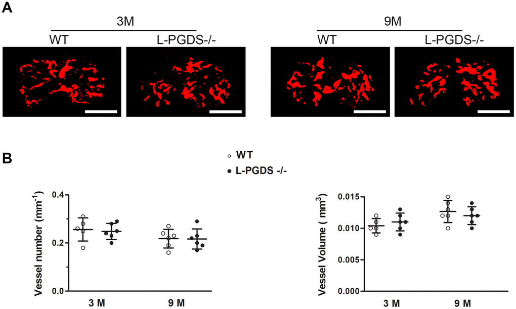 Micro-CT-based microangiography of the tibial subchondral bone of WT and L-PGDS-/- mice at 3 and 9 months. Subchondral bone angiogenesis in WT and L-PGDS-/- mice at 3 (n = 5 for WT, n = 6 for L-PGDS-/-) and 9 months (n = 6 per genotype) of age was evaluated by micro-CT angiography. (A) Representative 3D micro-CT-based micro-angiography of tibial subchondral bone at 3 and 15 months. Scale bars=1 mm. (B) Quantification of vessel volume (VV) and vessel number (VN) in the subchondral bone region of WT (open symbols) and L-PGDS-/- (filled symbols) mice. Data are presented as mean ± SD.