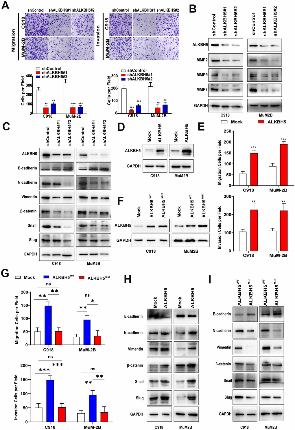ALKBH5 promoted UM cell migration, invasion, and EMT. (A) After ALKBH5 knockdown plasmid transfection for 24 hours, the transwell migration assay and Matrigel invasion assay were used to determine cell migration and invasion ability, respectively, in C918 and MuM-2B cells. (B) After transfection with shRNA-targeted ALKBH5, the expression of MMP2, MMP7, and MMP9 was detected using western blot. (C) Knockdown of ALKBH5 decreased mesenchymal markers (N-cadherin, vimentin, Snail, Slug, and β-catenin) and increased epithelial marker (E-cadherin) in UM cells. (D) The ALKBH5 overexpression efficiency was verified at the protein level in UM cells by western blot assay. (E) Upregulation of ALKBH5 increased cell migration and invasion abilities in UM cells. (F) Western blot assay was used to detect the ALKBH5 protein level by transfecting UM cells with wild-type or catalytic inactive mutation plasmid of ALKBH5. (G) Compared with ALKBH5 wild-type plasmid transfection, catalytic inactive mutation of ALKBH5 decreased the migration and invasion of UM cells. (H) Overexpression of ALKBH5 increased the expression of EMT markers. (I) Loss of ALKBH5 catalytic activity suppressed the expression of EMT-related proteins in UM cells. Mean ± SEM, t-test, *P P P 