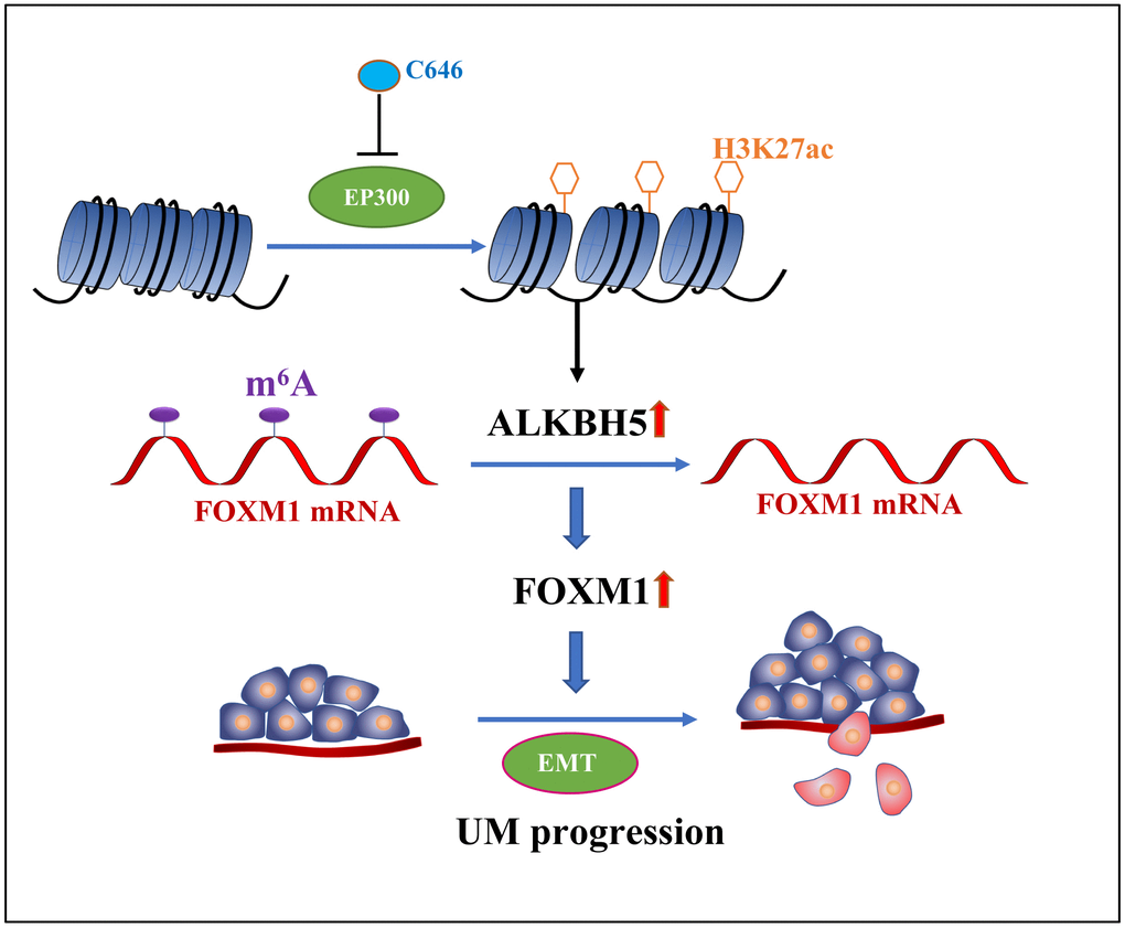 The graphic illustration of ALKBH5-mediated m6A demethylation of FOXM1 mRNA promotes progression of uveal melanoma.