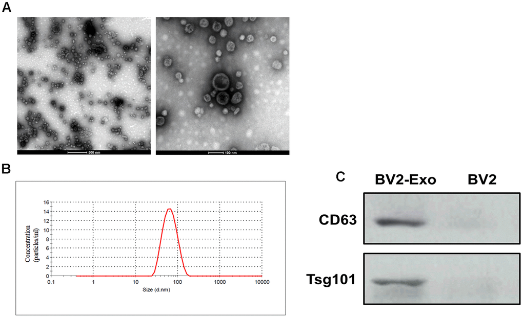 Identification of M2-phenotype microglia-derived exosomes (BV2-Exo). (A) Morphology of BV2-Exo, as determined by transmission electron microscopy. Scale bar = 500 nm (left panel) and 100 nm (right panel). (B) Size distribution of exosomes, as determined by nanoparticle tracking analysis. (C) Expression of exosome markers CD63 and Tsg101 in BV2-Exo and BV2 cells. Data are presented as mean±SD. *, p