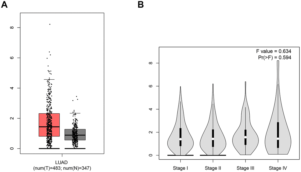 The expression level of ACE2. (A) The box-plot showed the comparison of ACE2 mRNA level in normal tissues vs. LUAD tissues. The red samples represent tissues from LUAD patients and the gray ones represent tissues from healthy persons. (B) The violin plot showed the expression level of ACE2 in different stages of LUAD. The parameters were listed in the upper right.