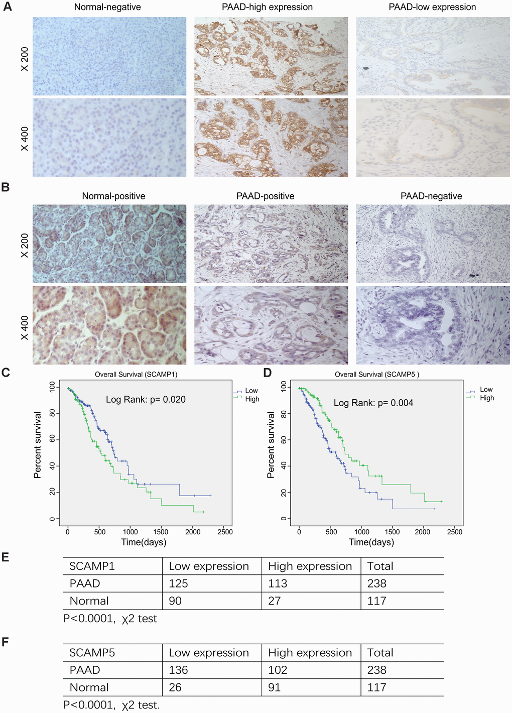 Relationship SCAMP1, 5 expression and the clinicopathological parameters of PAAD patients. (A, B) Representative images of SCAMP1 and SCAMP5 staining in PAAD tissue. (Expression of SCAMP1 and SCAMP5 were evaluated semi-quantitatively based on staining intensity and cell positivity, representative images are shown at × 200 and × 400 magnification, respectively.) (C, D) Kaplan–Meier analysis of the overall survival of PAAD patients stratified by the SCAMP1 and SCAMP5 immunoreactive scores by SPSS version 19.0. Log-rank test were performed to compare differences between groups. (E, F) Quantification of SCAMP1, 5 expression in pancreatic cancer and adjacent normal samples. Statistical analyses were performed using the χ2 test. Low: low expression, High: high expression.