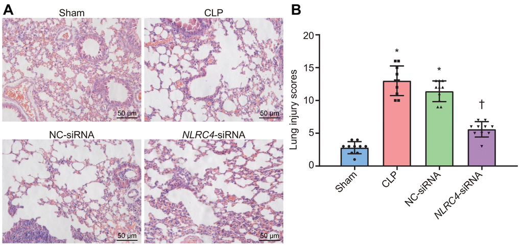 HE staining results illustrate the amelioration of lung tissue injury induced by septic shock in mice after DCs transfected with NLRC4-siRNA. (A) The lung tissue injury detected by HE staining (scale bar = 50 μm). (B) The lung tissue injury scores. n = 10. * p p 