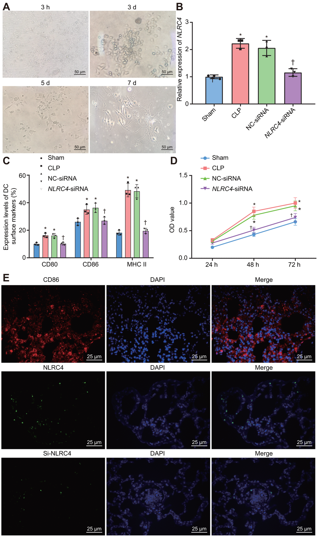 Improved morphological changes in DCs after being cultured for 3 h, 3 d, 5 d, and 7 d and suppressed NLRC4 reduces DC proliferation. (A) Morphological changes of DCs observed under an inverted microscope (scale bar = 50 μm). (B) The expression of NLRC4 in DCs determined by RT-qPCR. (C) The induction of DC surface markers, CD80, CD86, and MHC II, detected by flow cytometry. (D) The DC apoptosis as indicative of OD values detected by flow cytometry. (E) The immunofluorescence labeling of NLRC4 and DC surface marker CD86 (scale bar = 25 μm). The bone marrow-derived DCs from the same group of mice were adopted in the in vivo experiments. * p p 