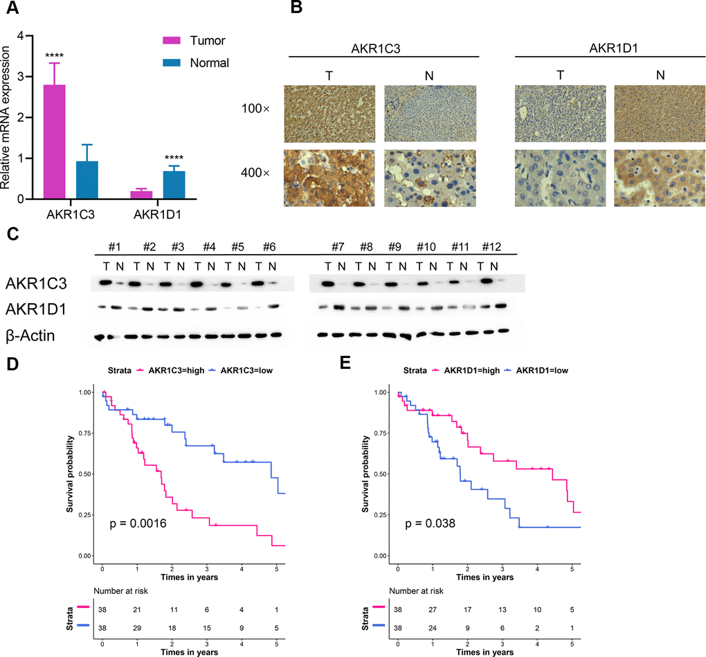 Extra validation of AKR1C3 and AKR1D1 in the test set. (A) Relative mRNA expression of AKR1C3 and AKR1D1 between tumor and normal. (B) The IHC staining results of AKR1C3 and AKR1D1. (C) The protein level of AKR1C3 and AKR1D1 between tumor and normal tissues. (D) The survival curve of AKR1C3 in the test set. (E) The survival curve of AKR1D1 in the test set.