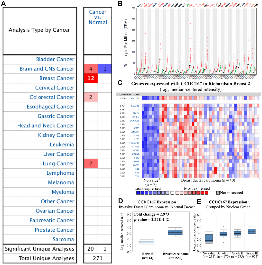Gene expression profiles of coiled-coil domain-containing protein 167 (CCDC167) in normal breast tissues and breast cancer. (A) Expression levels of CCDC167 in different types of cancers compared to normal tissues. The CCDC167 gene was found to have upregulated expression in various tissue types, and the color gradient represents a lower gene rank percentile. (B) CCDC167 expression level from 33 cancer datasets with transcripts per million (TPM) levels using the GEPIA database. Significant CCDC167 overexpression in cancers is highlighted in red, including the BRCA dataset, whereas downregulation is labeled in green. (C) Co-expression patterns of CCDC167 in the Oncomine database. CCDC167 is also called C6orf129. (D) CCDC167 expression was higher relative to normal breast tissues in the METABRIC database. (E) Correlations between CCDC167 and histological differentiation of breast cancer, with increasing expression levels of CCDC167 as tumors progressed from low to high grade.