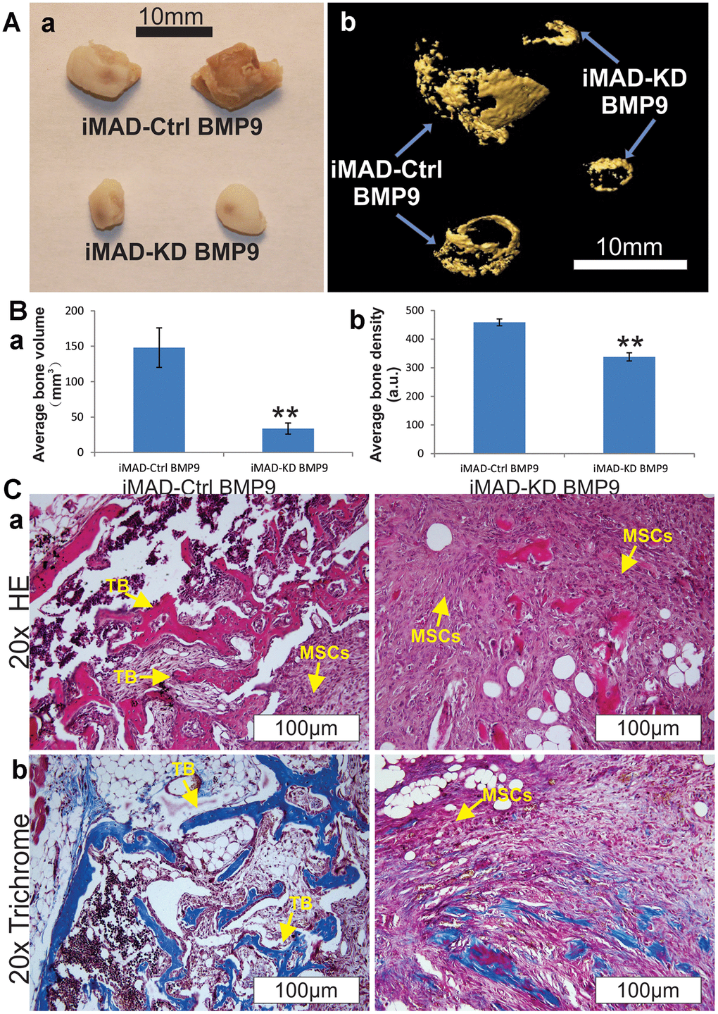 HOTAIR knockdown attenuates BMP9-induced ectopic bone formation from iMAD cells in vivo. (A) Gross view (a) and μCT imaging (b) of the BMP9-induced ectopic bone formation from iMAD-Ctrl and iMAD-KD cells. The retrieved bone masses from indicated groups were imaged using μCT followed by 3D reconstruction (b). No detectable masses were retrieved from the Ad-GFP-transduced iMAD-Ctrl or iMAD-KD cells group. (B) The average bone volumes (a) and average bone density (b) for the indicated groups were determined and analyzed using the Amira program. Representative images are shown. “**” p C) HE (a) and Trichrome staining (b) of the retrieved bone masses. Representative images are shown. TB, trabecular bone; MSCs, undifferentiated MSCs.